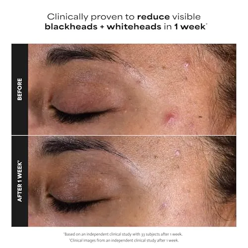 Paula's Choice 2% BHA Liquid Exfoliant Review image 4
