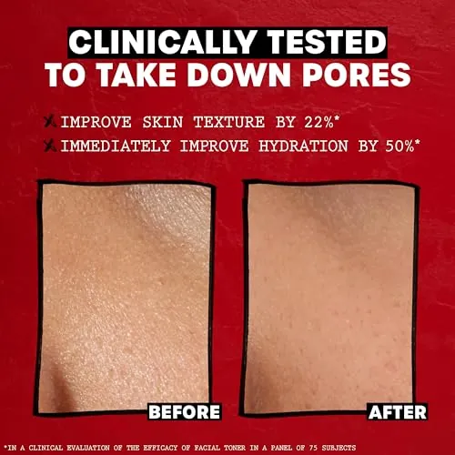 THAYERS Alcohol-Free Witch Hazel Toner Review image 5