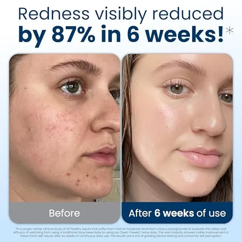 Clean Skin Club Clean Towels XL Review: Disposable Face Towel image 3