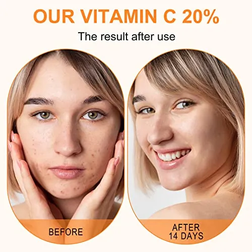 ELBBUB Premium 20% Vitamin C Serum Review image 5