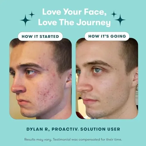 Proactiv 3 Step Acne Treatment Review: 90 Day Acne Kit image 6